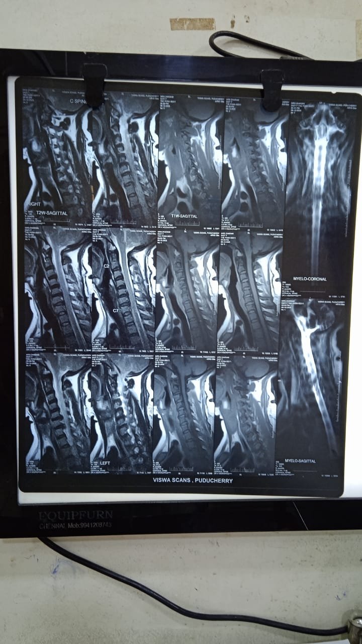 Cervical assessment